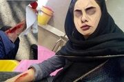 دانش‌آموزانی که از « خون‌ بازی» لذت می‌برند!