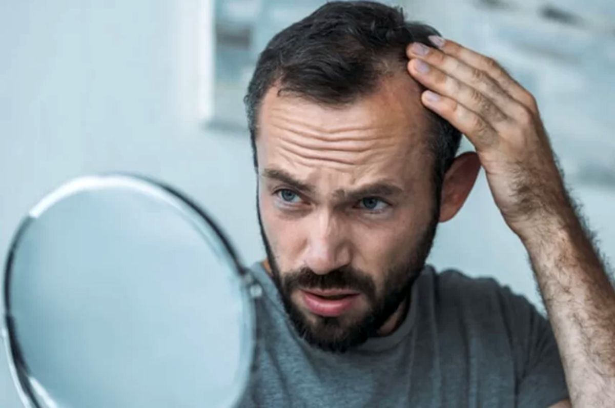 آیا افسردگی باعث ریزش مو میشود ؟ 