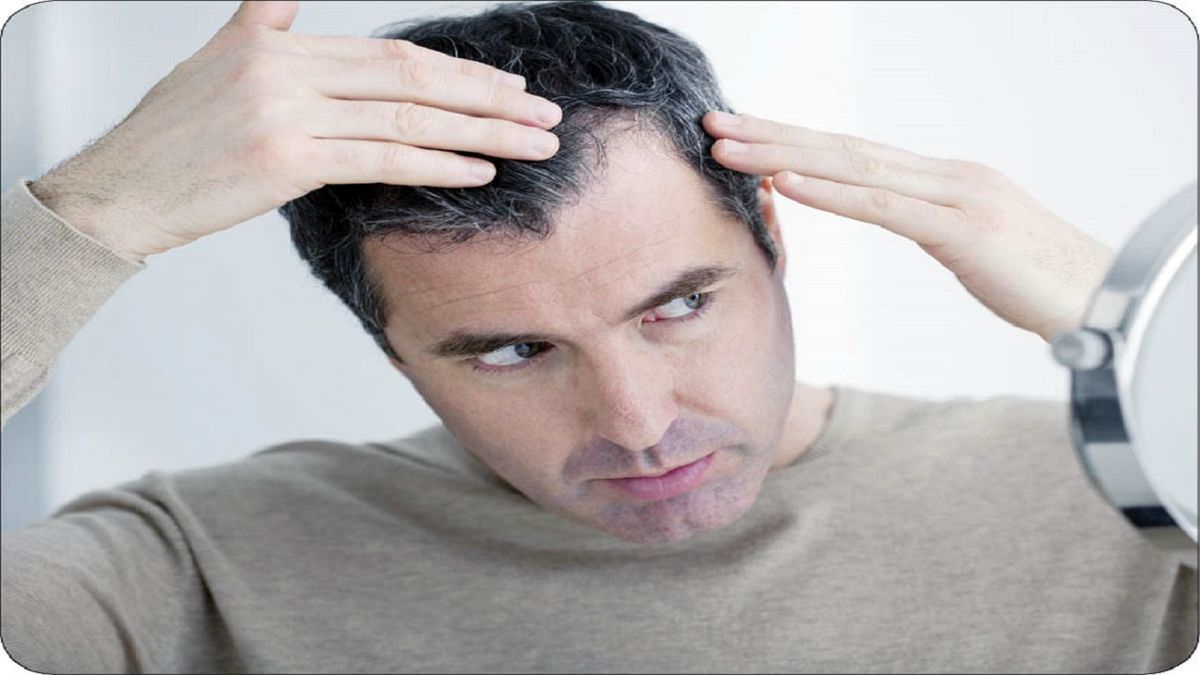 علت ریزش موی سر پس از ابتلا به کووید ۱۹
