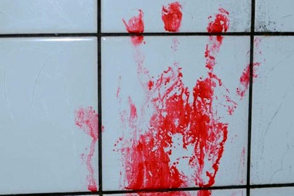 باند بین‌المللی قاچاق اعضای بدن در تهران لو رفت