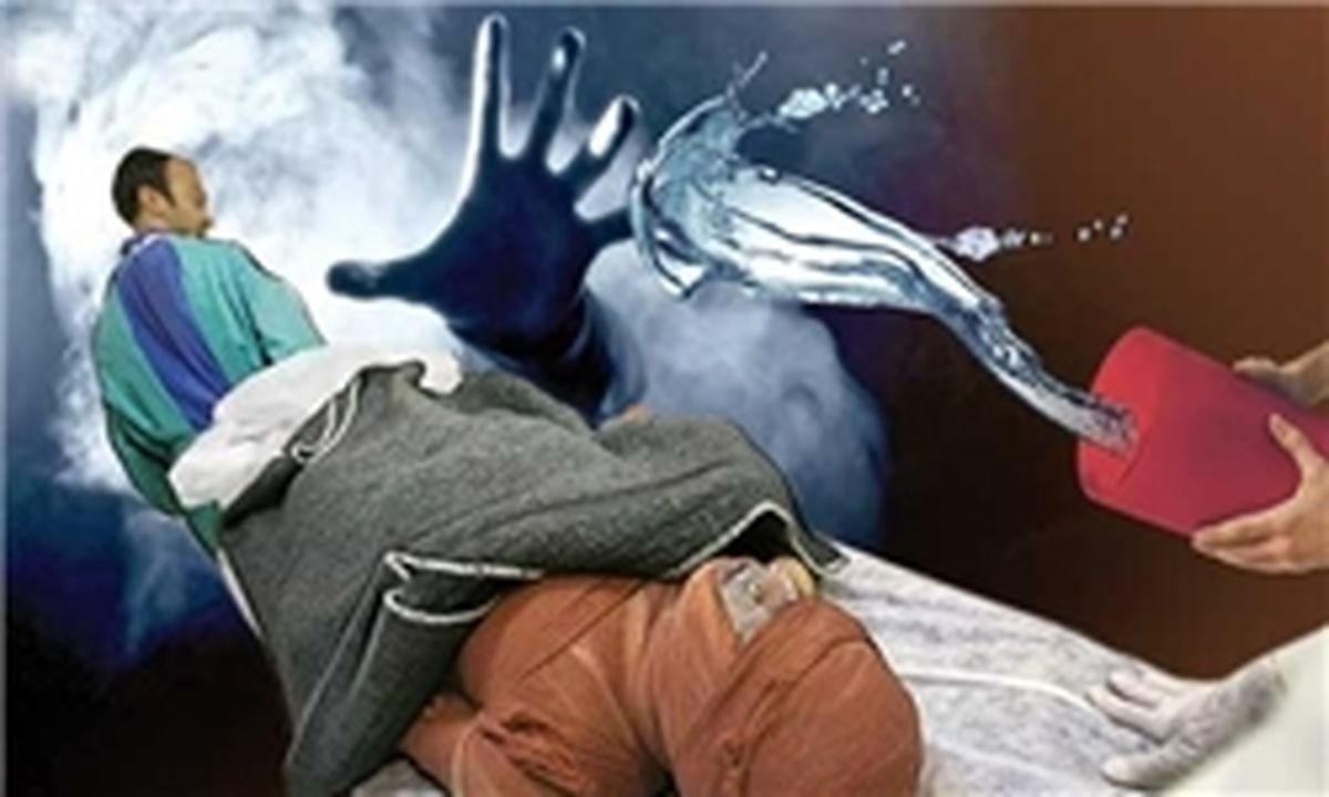حکم قصاص عضو اجرا شد