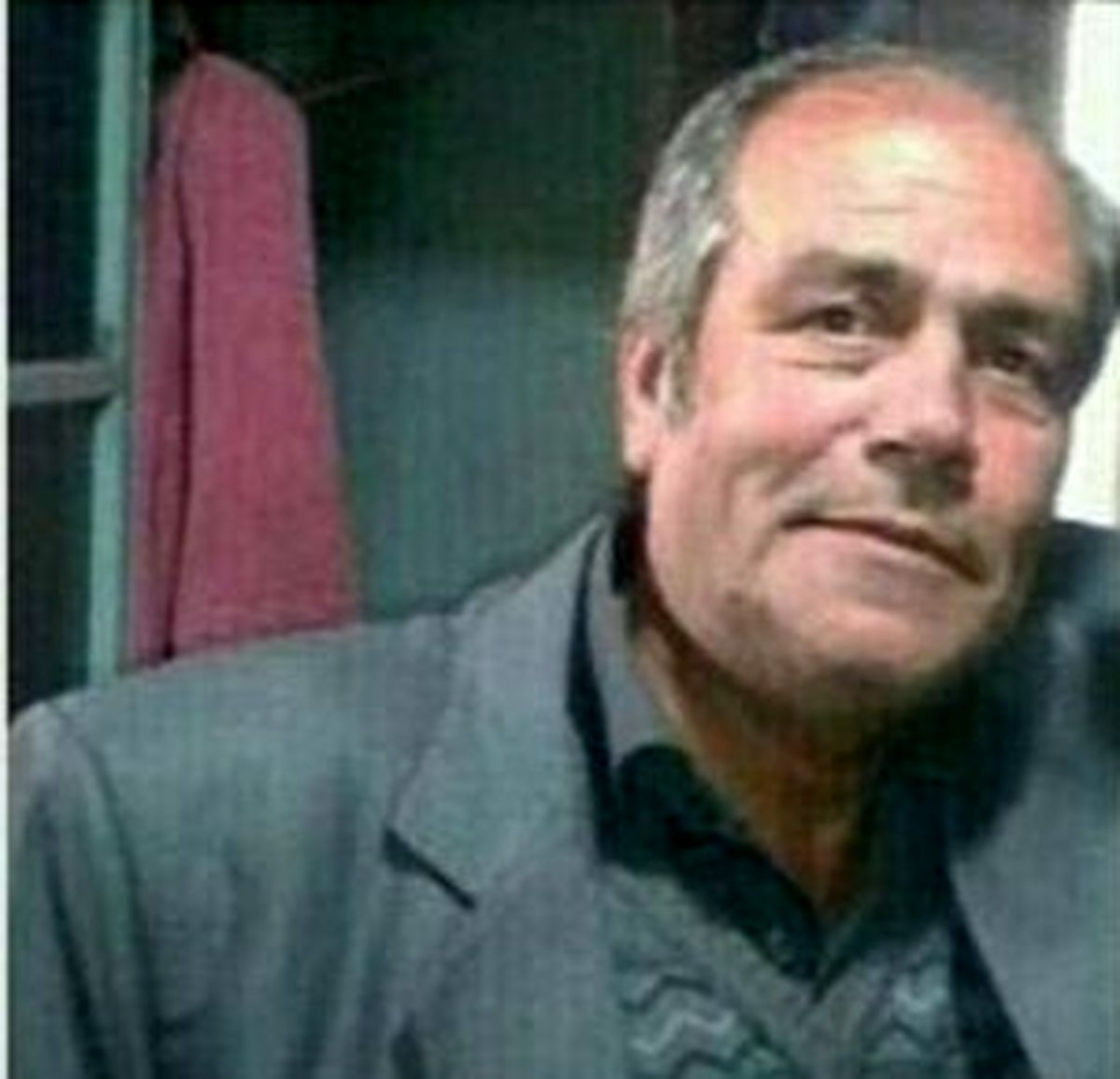 بازیگر «قلاده‌های طلا» زیر تیغ جراحی/عکس