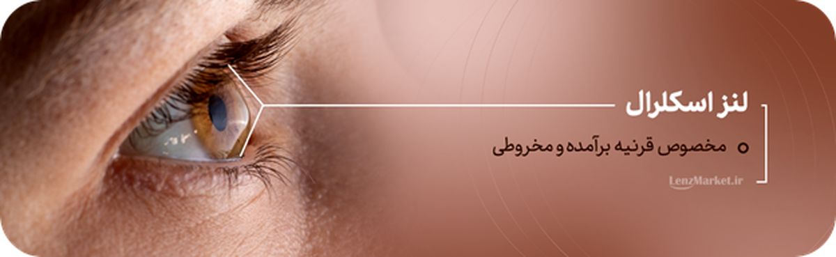 لنز داخل چشم چیست؟