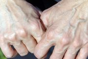 ۱۰ دلیل لرزش دست‌ها که از آن بی‌اطلاعید