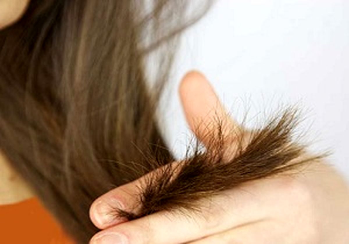۷ روش برای خلاصی از موخوره+ اینفوگرافیک
