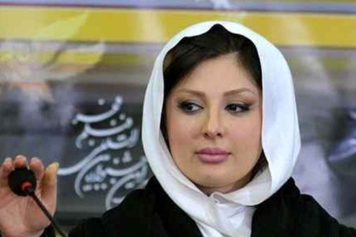 تغییرات چهره بازیگر زن مشهور پس از بارداری/عکس
