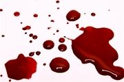 تعیین سن مقتول با خون کشفشده در صحنه جرم