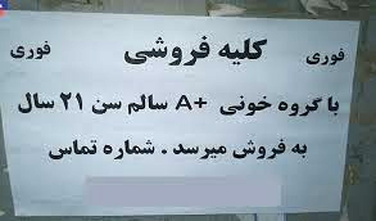 معاوضه کلیه با خودرو!
