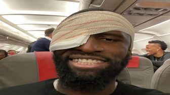 رودریگر با ۲۰ بخیه در الکلاسیکو حاضر می‌شود
