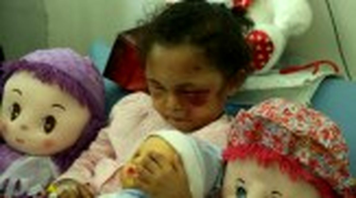 تازه ترین عکس های بثینه دختر بچه یمنی