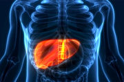 مهم ترین دلیل بروز کبد چرب + درمان