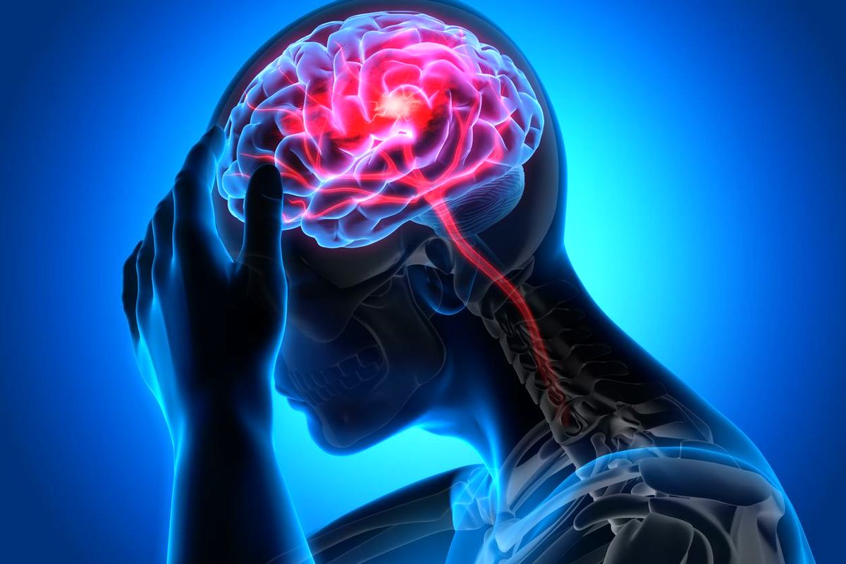 عوارض سکته مغزی چیست
