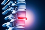افراد دارای دیسک کمر چطور درمان می‌شوند؟