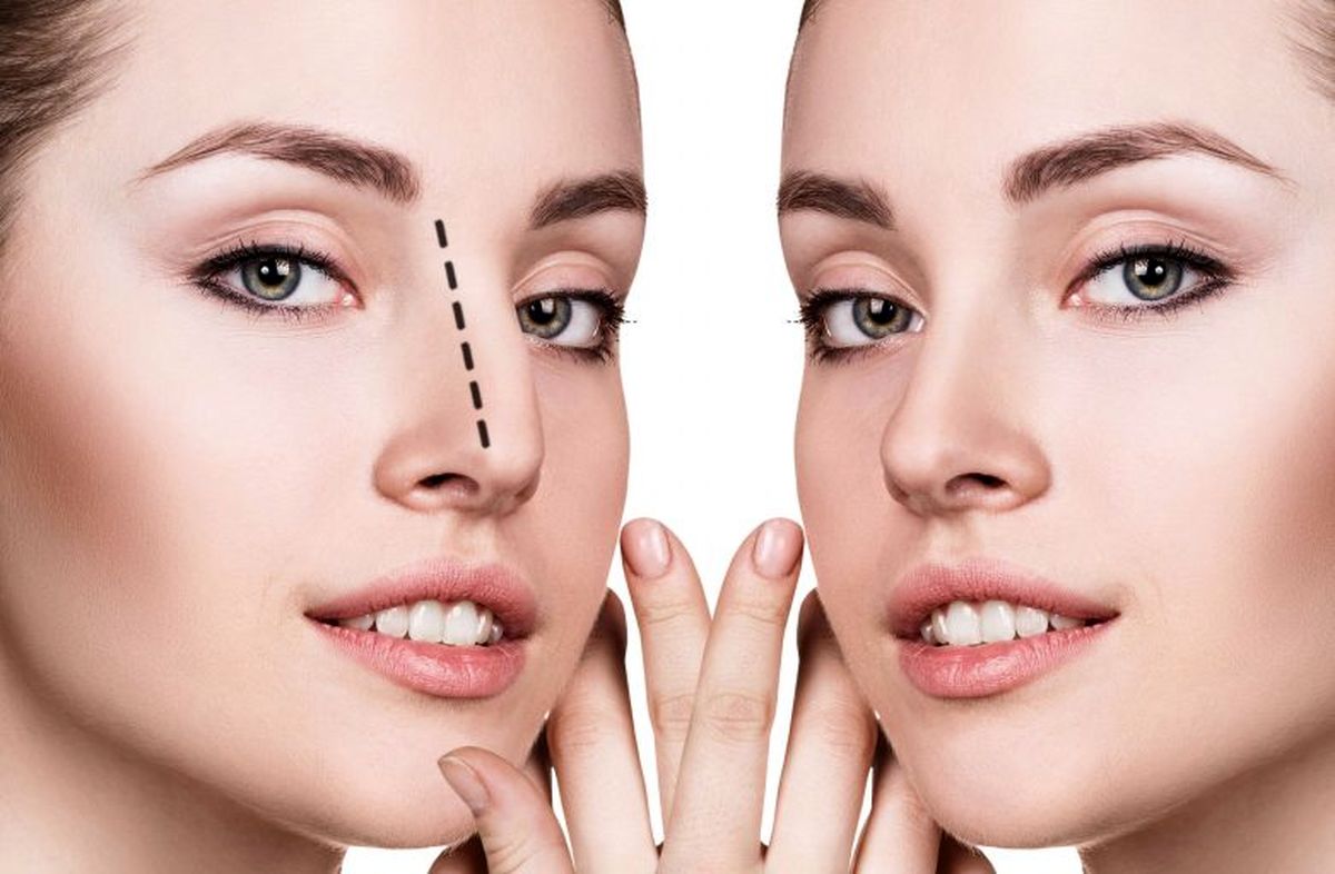 ممنوعیت عمل زیبایی در ایام کرونایی