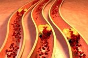 نشانه‌های هشداردهنده مصرف بیش از حد چربی + جزئیات
