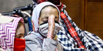 کار کثیف شرکت سوئدی با کودکان پروانه ای ایران