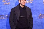 بازیگر کرگدن تغییر چهره داد /  عکس
