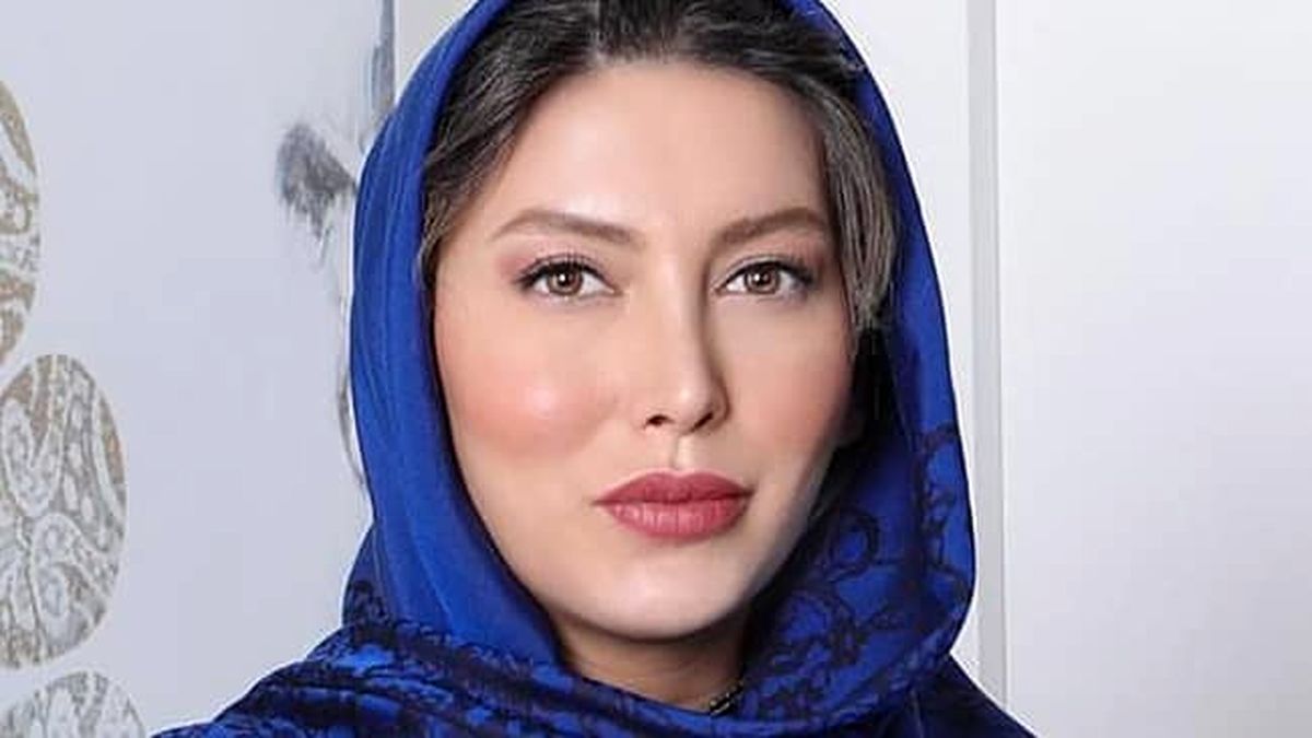 چهره فریبا نادری پیش از عمل جراحی+فیلم