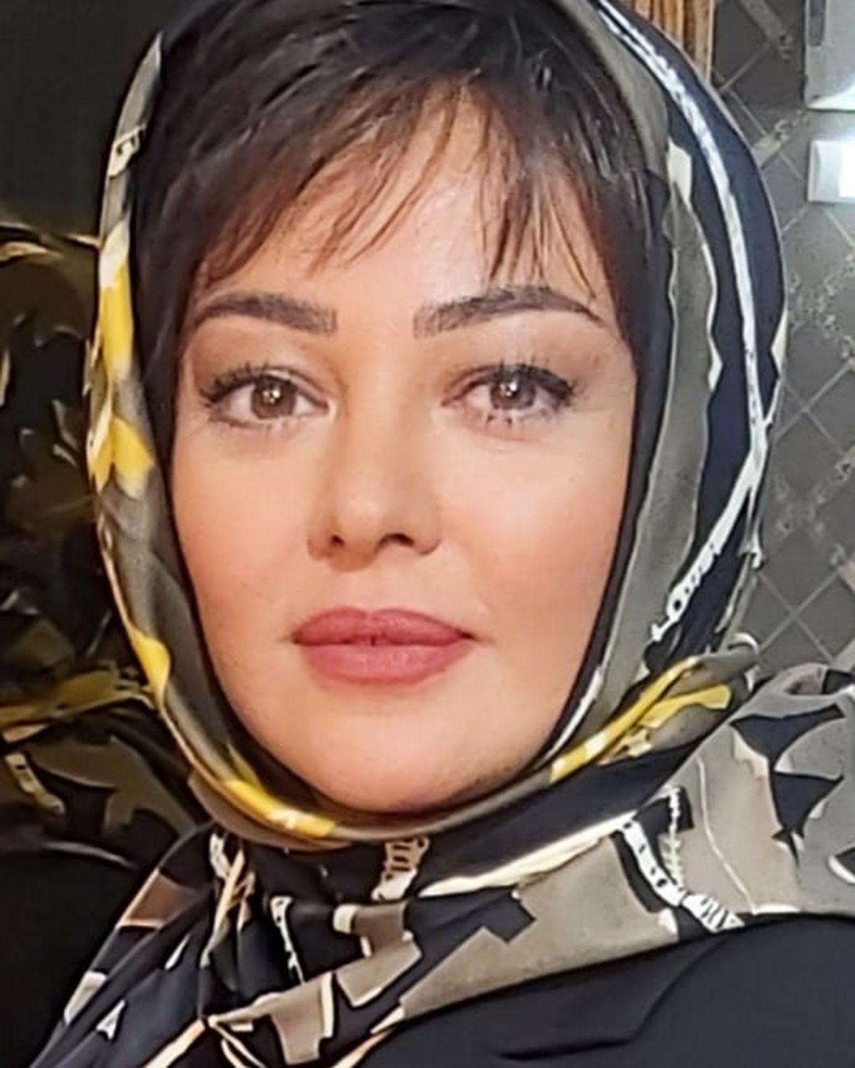 وقتی «رزیتا غفاری» دندان پزشک می شود/ عکس