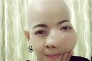  بی‌توجهی خانم تایلندی به دندان درد+ عکس