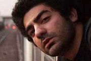 سوختگی شدید بازیگر جوان /عکس