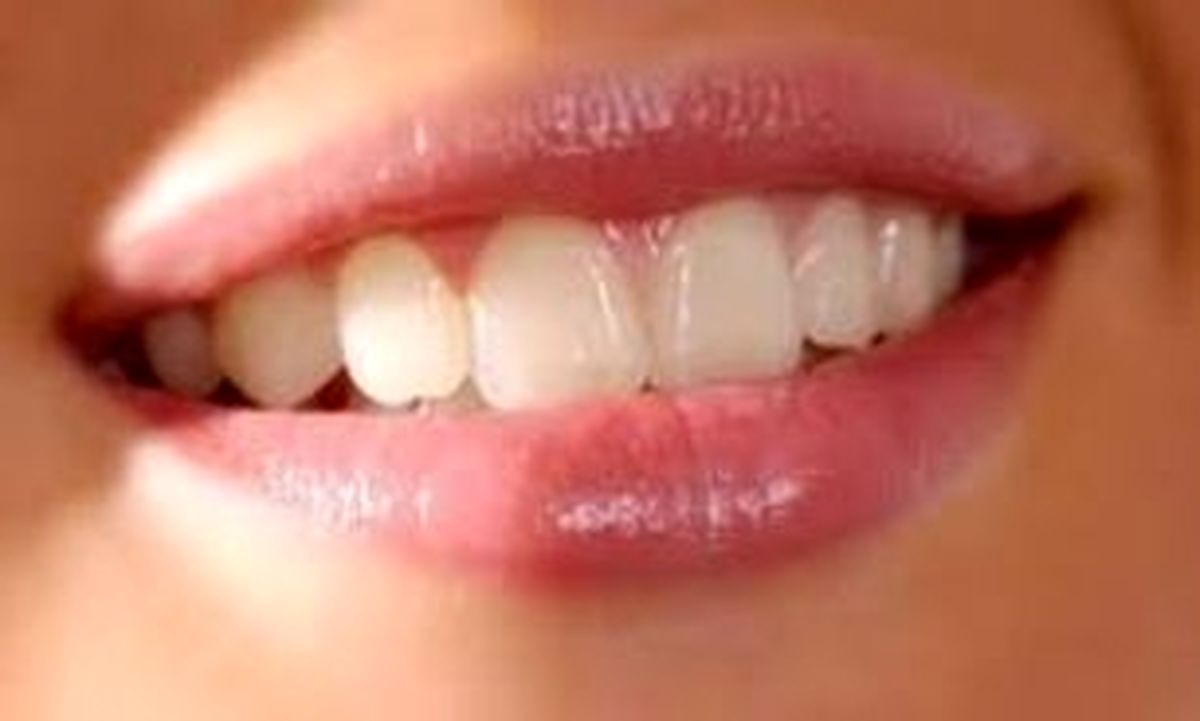 این ماده مغذی محافظ لثه است