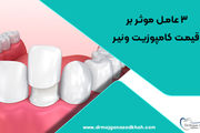 3 عامل موثر بر قیمت کامپوزیت ونیر

