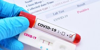 کرونا ۱۵ قربانی گرفت/۲۳ استان بدون مرگ و میر کرونایی