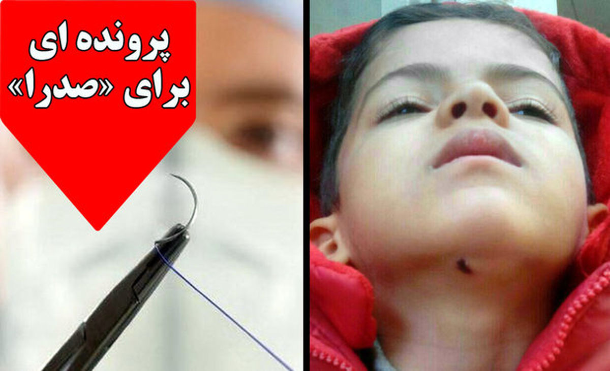 زوایایی پنهان ماجرای کودکی که بخیه اش کشیده شد