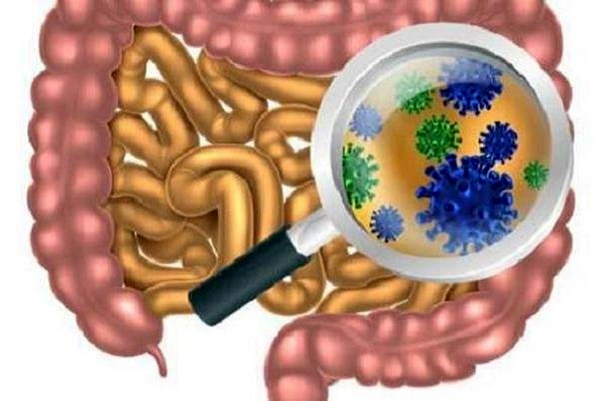 این گروه از افراد در معرض ابتلا به سرطان روده هستند