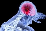 آیا بیماران MS رژیم غذایی خاصی دارند؟