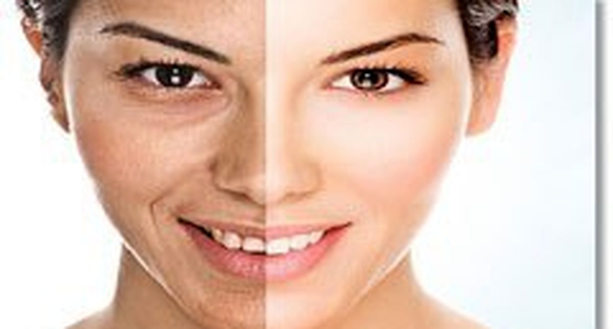 ابداع روشی جدید برای کاهش آثار زخم
