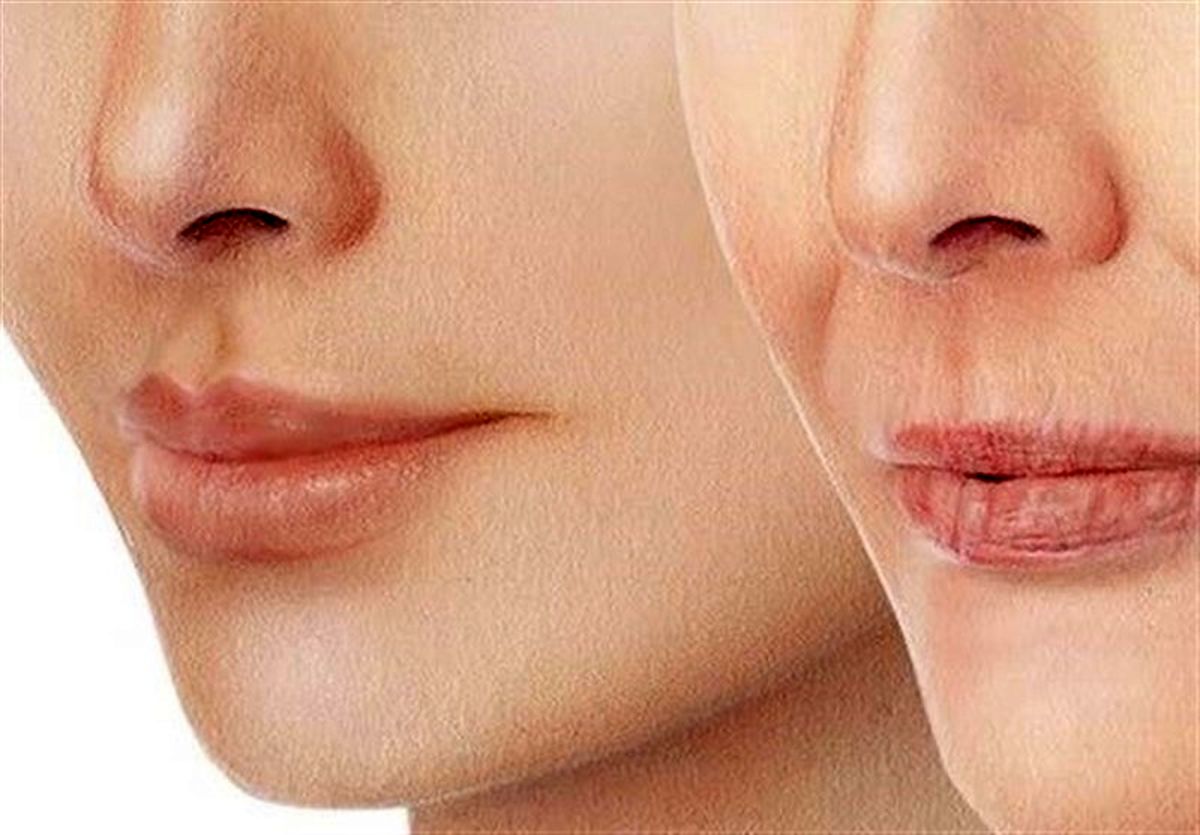 ترفند‌های جالب برای لاغری سریع صورت تا عید