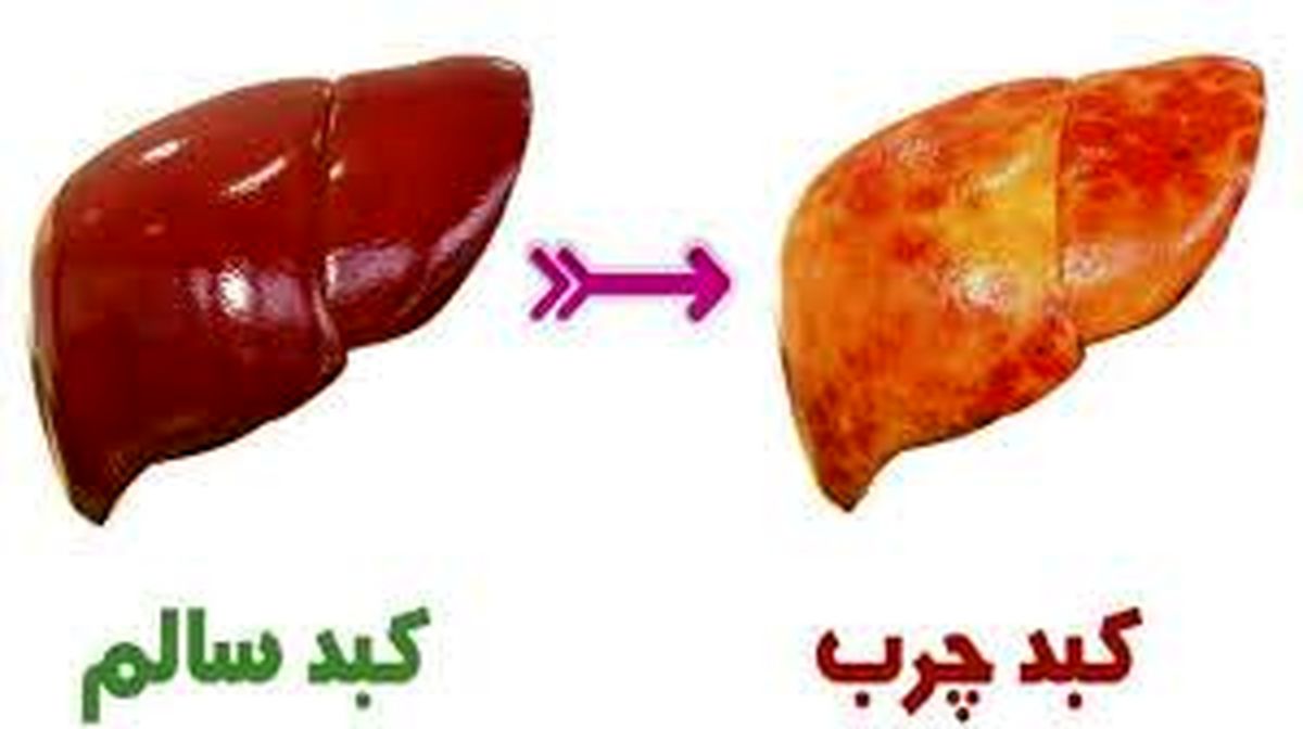 این میوه خوشمزه هم کبد چرب را درمان می‌کند هم باعث طول عمر می‌شود

